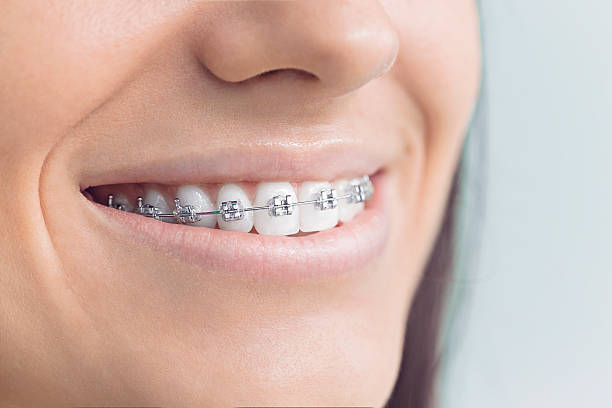 Best Dental Bonding  in Arp, TX